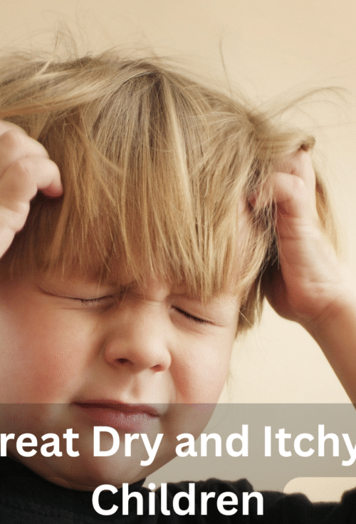 How to Treat Dry and Itchy Scalp in Children