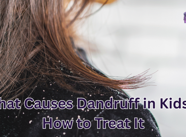 What Causes Dandruff in Kids & How to Treat It
